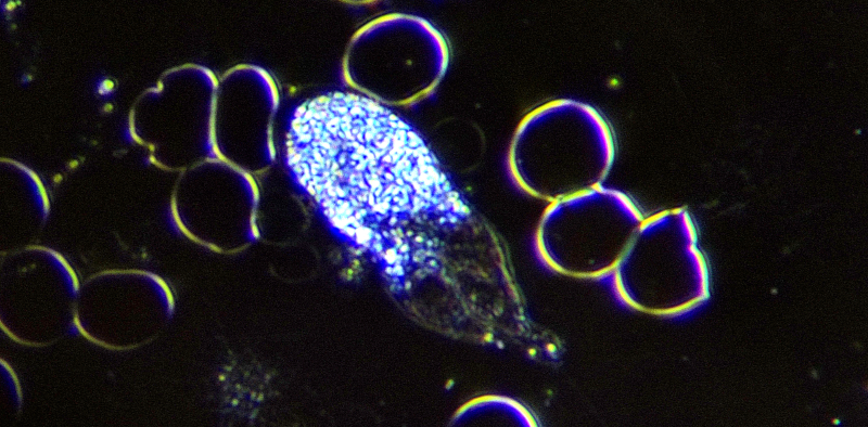 image of a White Blood Cell in motion, Laurier Herbalist